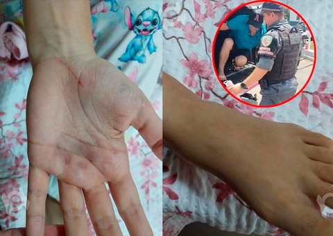 Marido que torturou blogueira foi candidato a vice-prefeito no Amazonas