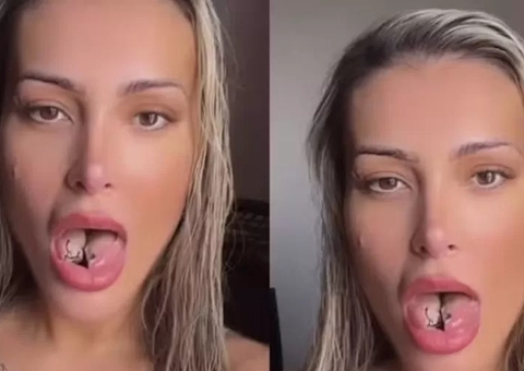 Andressa Urach passa sufoco após cirurgia na língua