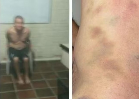 Funcionário de clínica suspeito de torturar paciente até a morte vira réu