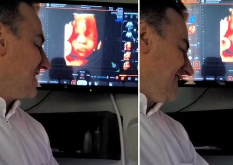 Reação de bebê ao ouvir o pai em ultrassom viraliza; assista