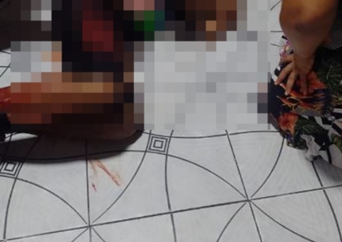 Idoso é baleado durante ataque criminoso em Manaus