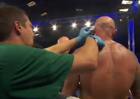 Vídeo: Boxeador fica com orelha pendurada após golpe de rival em luta
