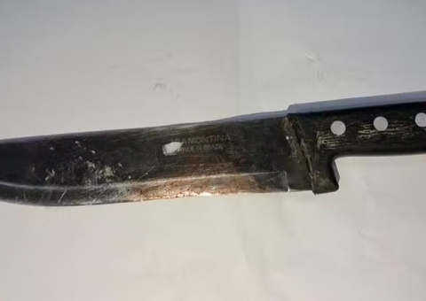 Mulher corta pênis do marido por falhar na hora 'H' em Rondônia