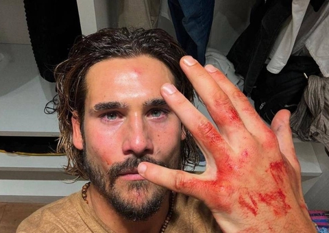 Nicolas Prattes se machuca de verdade e relata perrengue em gravação de 'Mania de Você'