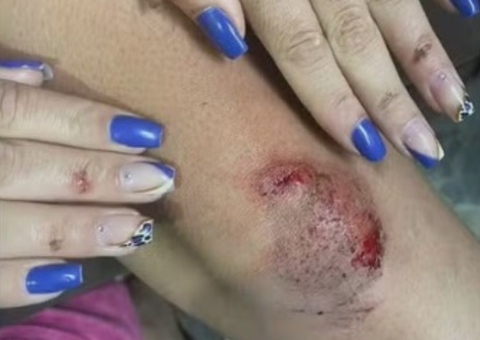 Jovem pula de carro em movimento após ser assediada por motorista de app