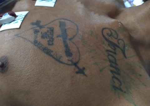 Hospital pede ajuda para encontrar família de paciente socorrido após agressão em Manaus