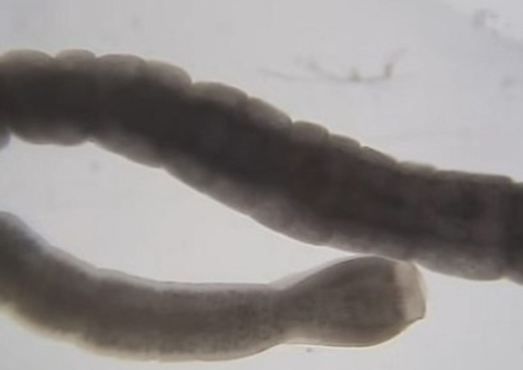 Mulheres comem ovos de tênia para emagrecer e médicos fazem alerta 