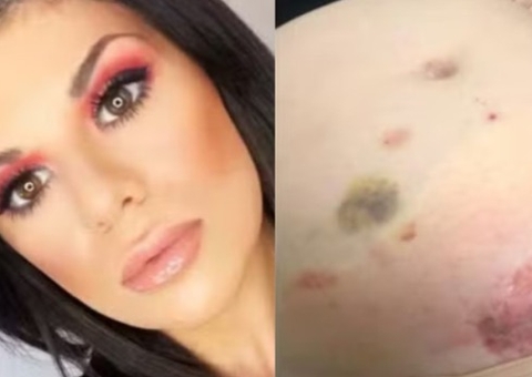 Australiana descobre cinco órgãos a mais no corpo após dores intensas