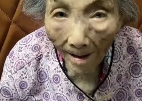 Idosa de 107 anos chama atenção com chifre de 10cm