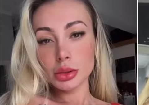 Andressa Urach mostra antes e depois de tatuar sardas no rosto