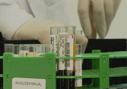Testes de HIV são refeitos em 45 transplantados após caso de erros em exames