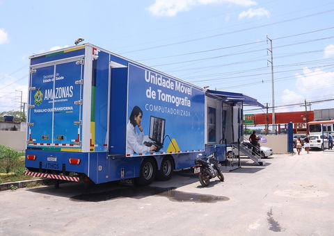 Carretas de Tomografia vão atender nas zonas oeste e sul de Manaus na próxima segunda-feira