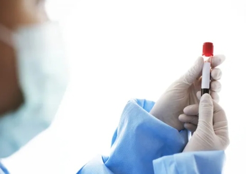 Falha de laboratório em exame de sangue gera obrigação de indenização no Amazonas