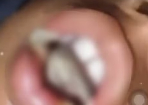 Avó é presa após castigar neto de 10 anos com ovo quente na boca