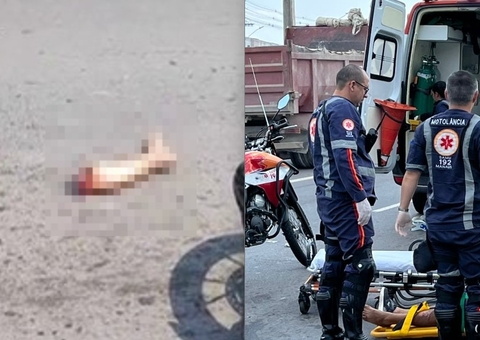 Passageira de moto tem perna arrancada em acidente violento na Av das Flores