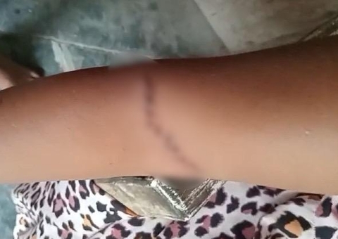 Mulher é atacada a facadas pelo ex-marido na frente dos filhos no Amazonas