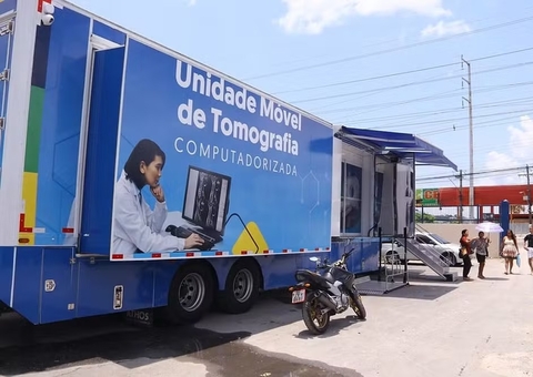 Carretas da Saúde e de Tomografia atendem nas zonas Oeste e Leste de Manaus