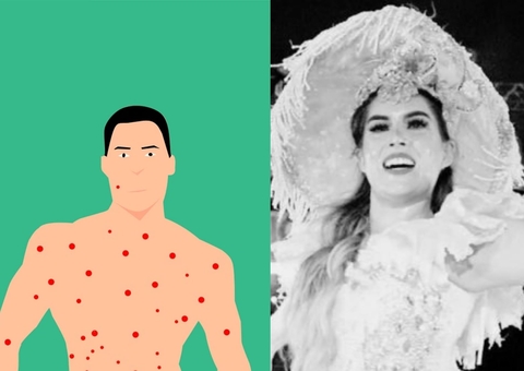 Mpox lidera buscas no Google em 2024; cetamina também está no top 10