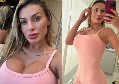 Andressa Urach faz rejuvenecimento íntimo: "Não vejo a hora de mostrar"