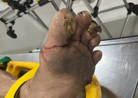 Homem recebe choque elétrico e despenca de árvore na Praça 14 