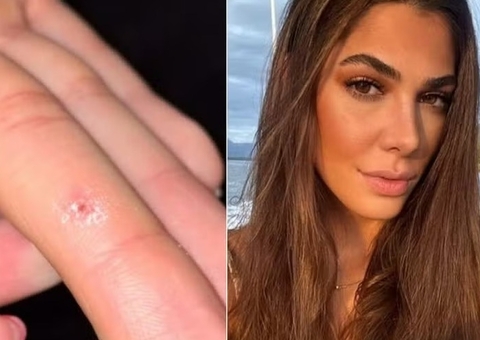 Mulher diz ter sido infectada com HPV após usar aparelho de academia