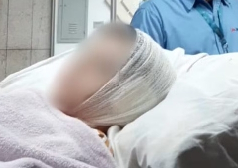 Criança tem parte da orelha arrancada em ataque de pitbull