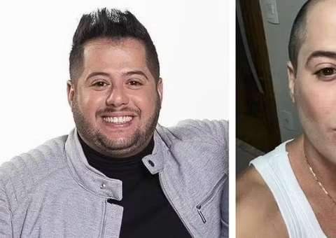 Hugo, da dupla com Tiago, surge irreconhecível após harmonização e lipo