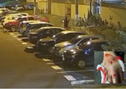 Mulheres são atacadas por pitbull em condomínio em Manaus; vídeo