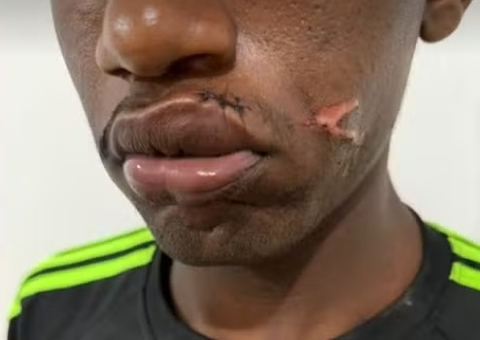 Mulher agride companheiro com pá após ele chegar tarde em casa