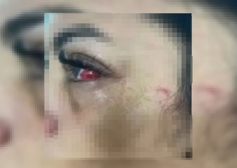 Homem agride companheira por beber sem ele na companhia de amigos