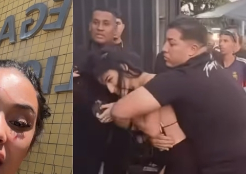 Jovem surge com rosto deformado após briga e desmente Bia Miranda