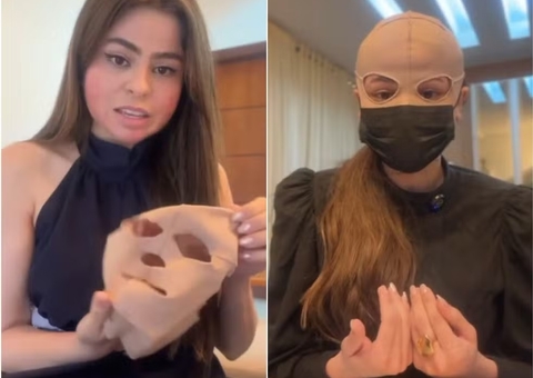 Médica sofre queimaduras no rosto após peeling e precisa usar máscara