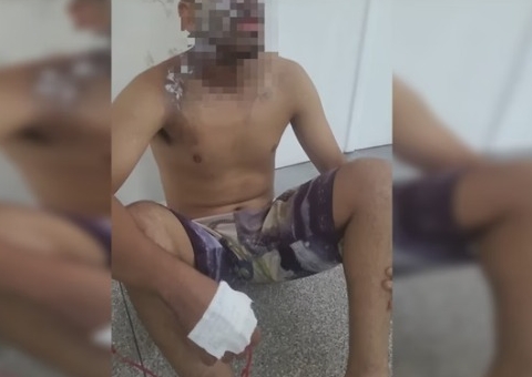 Mulher queima o rosto do companheiro com água fervente durante discussão