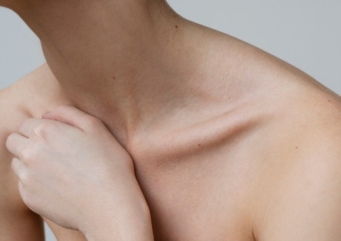 Mulher sofre AVC após chupão no pescoço