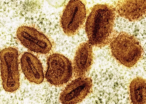 Brasil registra primeiro caso da nova cepa da Mpox