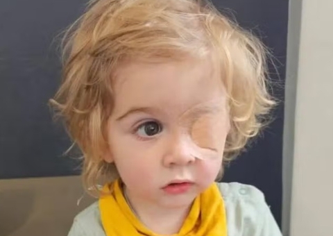 Menino perde a visão após ser beijado por pessoa com herpes labial