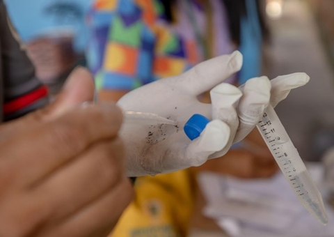 Arboviroses: Manaus acumula 378 casos de dengue