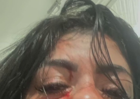 Cantor de forró é suspeito de espancar namorada em Manaus; vítima perdeu 3 dentes