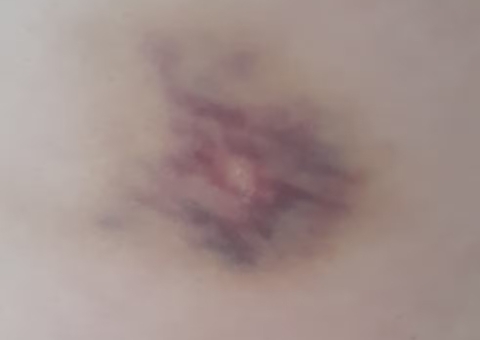 Professora é agredida a socos e ameaçada por aluna no Tocantins