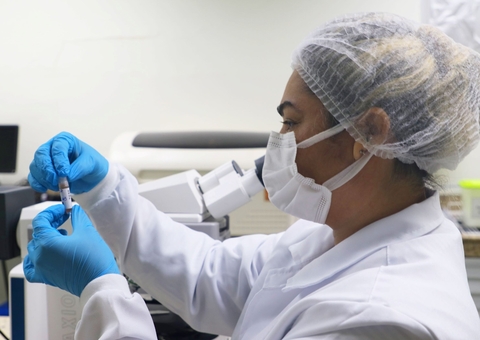 Amazonas registra 30 casos confirmados de Mpox em 2025