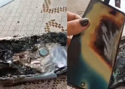 Celular explode no bolso e causa queimaduras graves em homem em SP