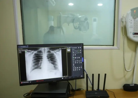 Brasil tem aumento de hospitalizações por Influenza A, alerta Fiocruz