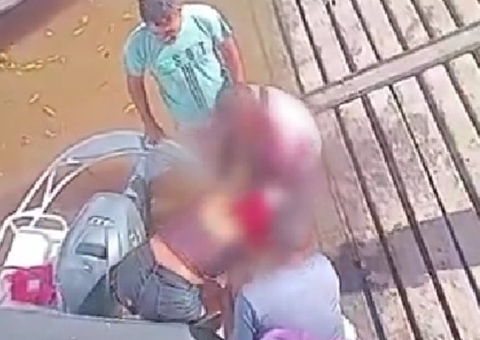 Cabelo de jovem é arrancado por motor de rabeta no Pará; Vídeo