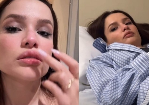 Juliette sofre acidente doméstico e fratura o nariz 