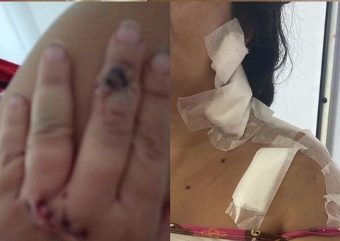 Mãe e filha de 10 meses são atacadas com gargalo de garrafa no bairro São Jorge