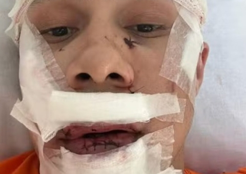 Após defender mulheres, personal é agredido e leva 45 pontos no rosto em SP