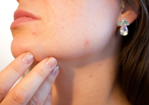 90 milhões de brasileiros nunca foram ao dermatologista, diz Datafolha