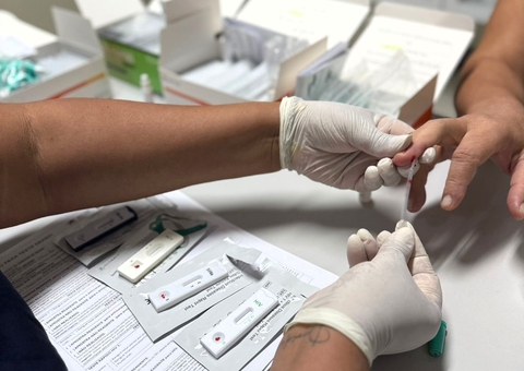 Casos de hepatites virais caem 34% no Amazonas no primeiro semestre de 2025