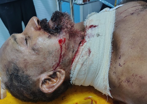 Criminosos atacam idoso a golpes de terçado no pescoço em Manacapuru