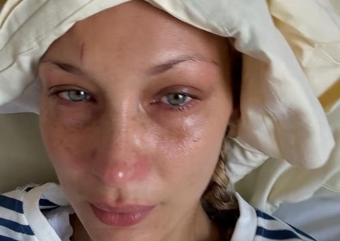 Bella Hadid é internada com doença de Lyme